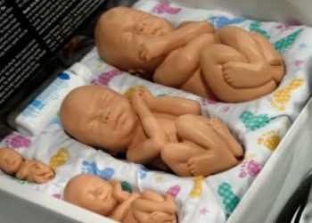 Etisk debat om begravelse af aborter
