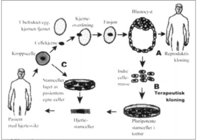 Stamceller og terapeutisk kloning